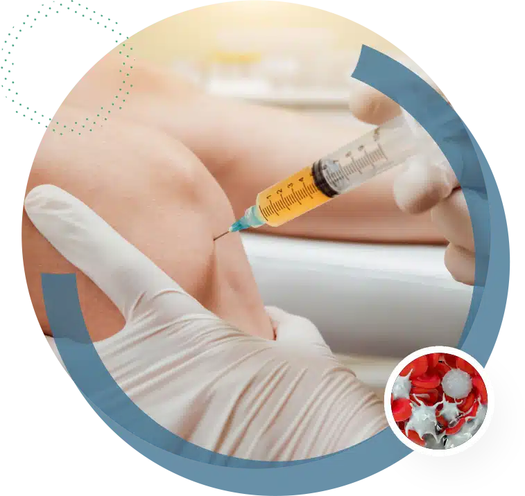 Joint replacement surgery